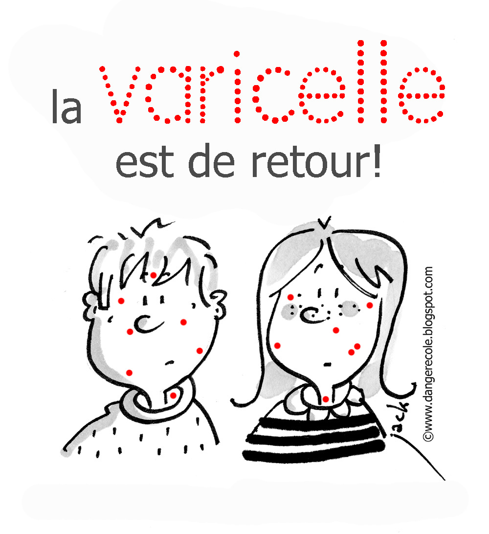 Les boutons rouges sur la personne bolyat se grattent